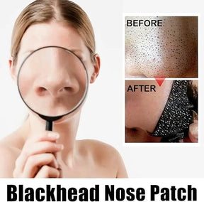 Nose Blackhead Strips s4strivehub